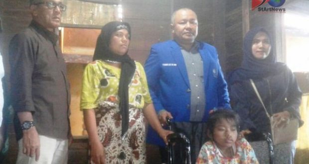 Aisyah. Penderita Lumpuh Layu dapat Bantuan dari Toguan Lubis