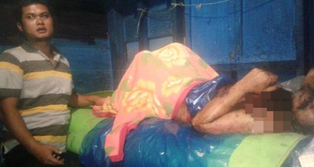Anggota DPRD Madina Sambangi Penderita Sakit Kulit Kritis di Desa Huta Pungkut